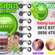 Illustration for article titled obat raja singa atau sipilis